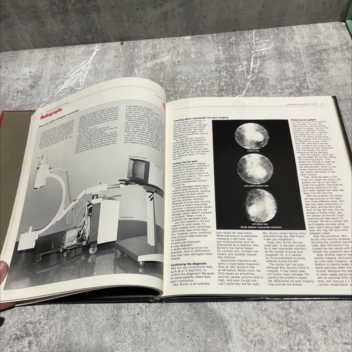 giving cardiac care book, by unknown, 1982 Hardcover image 4