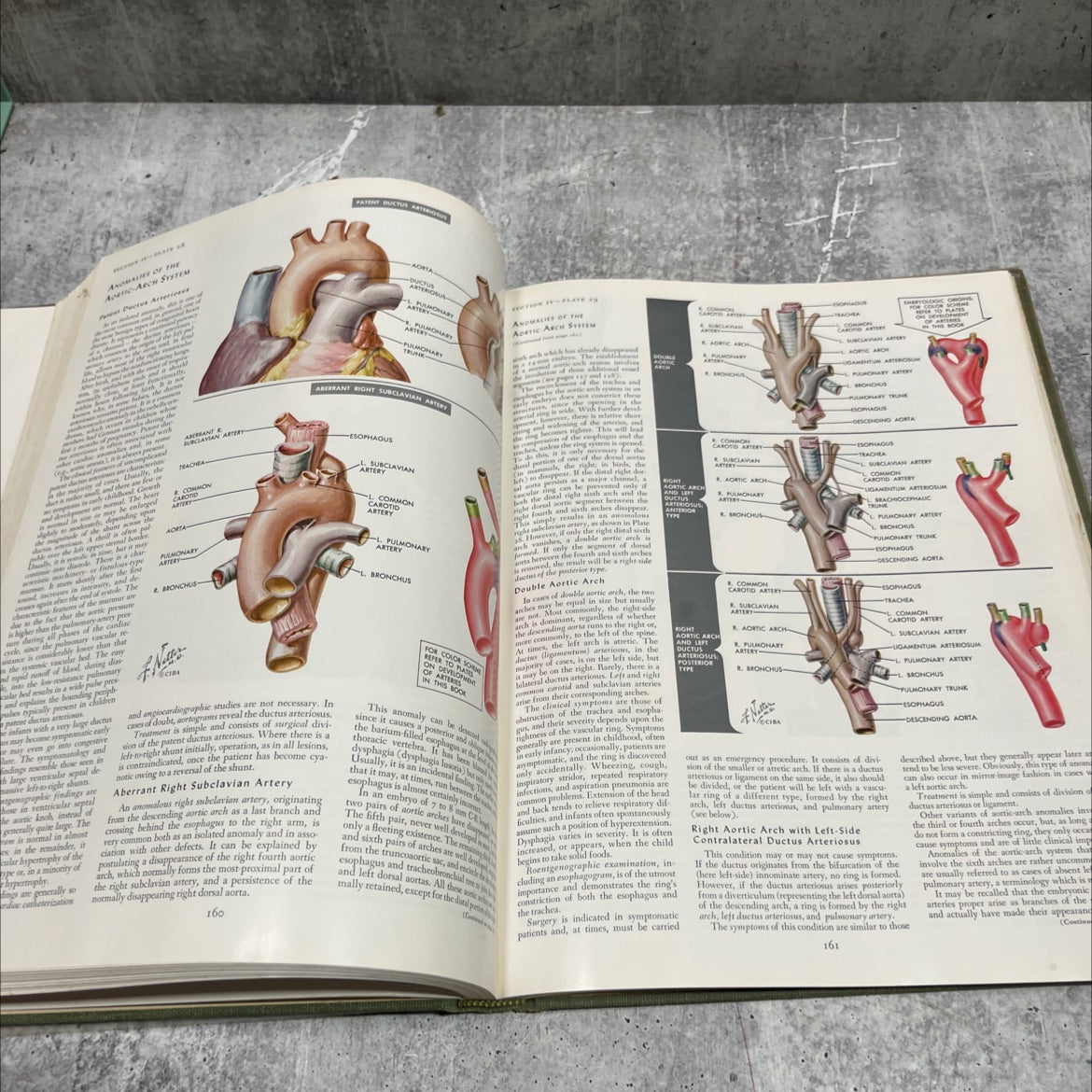 the ciba collection of medical illustrations volume 5 book, by frank h. netter, m.d., 1971 Hardcover image 4