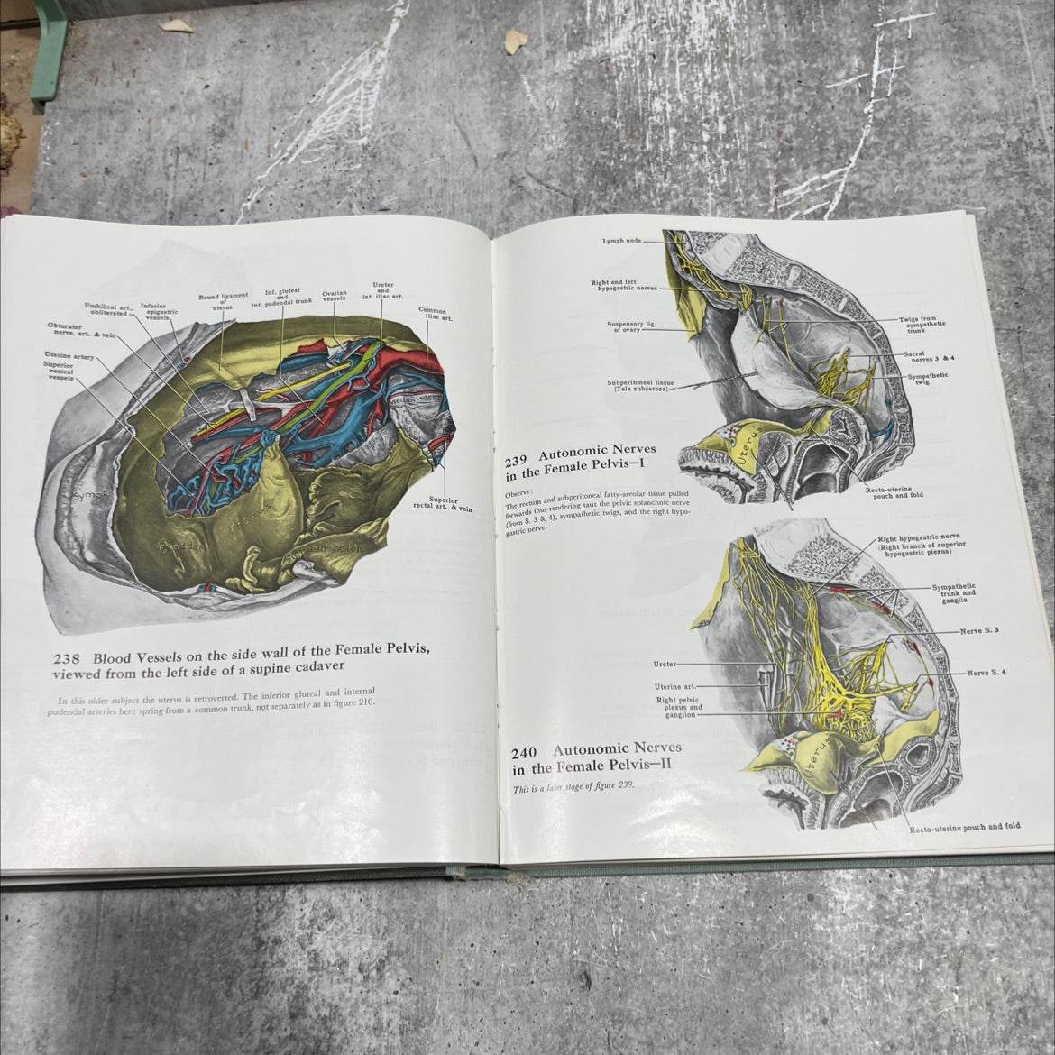 an atlas of anatomy pelvis, lower limb, vertebrae, vertebral column, by regions: upper limb, abdomen, perineum cranial image 4