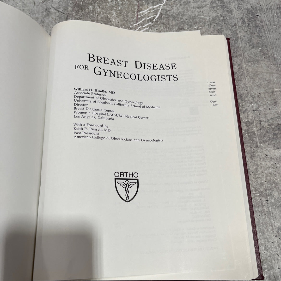 breast disease for gynecologists book, by William H. Hindle, MD, 1990 Hardcover image 2