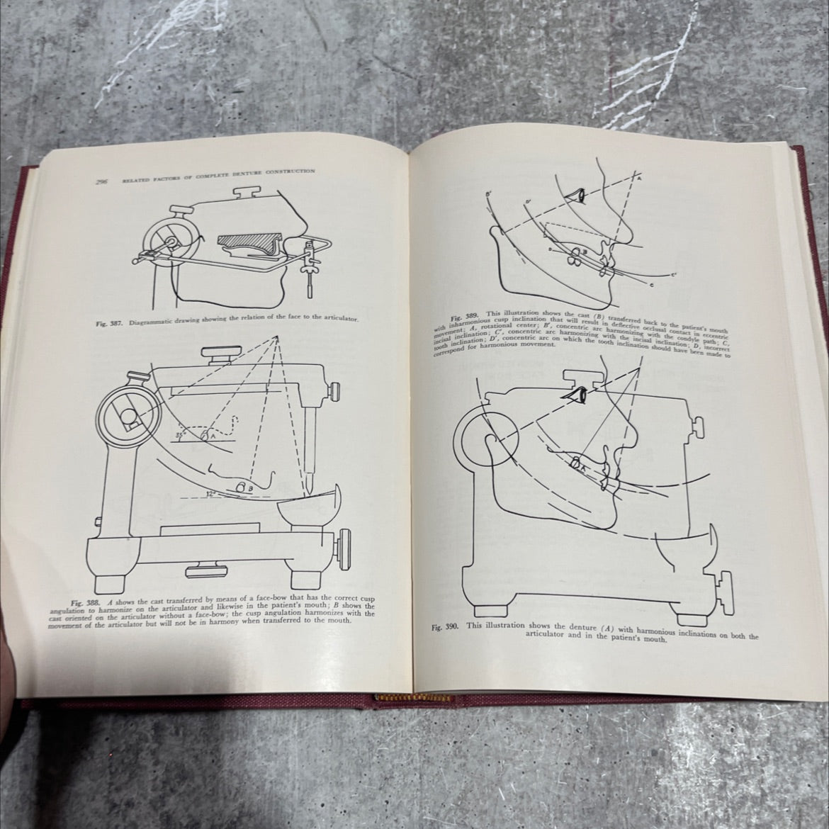 complete dentures book, by merrill g. swenson, d.d.s., f.i.c.d., f.a.c.d., charles j. stout, b.a., b.s., d.m.d., 1959 image 4