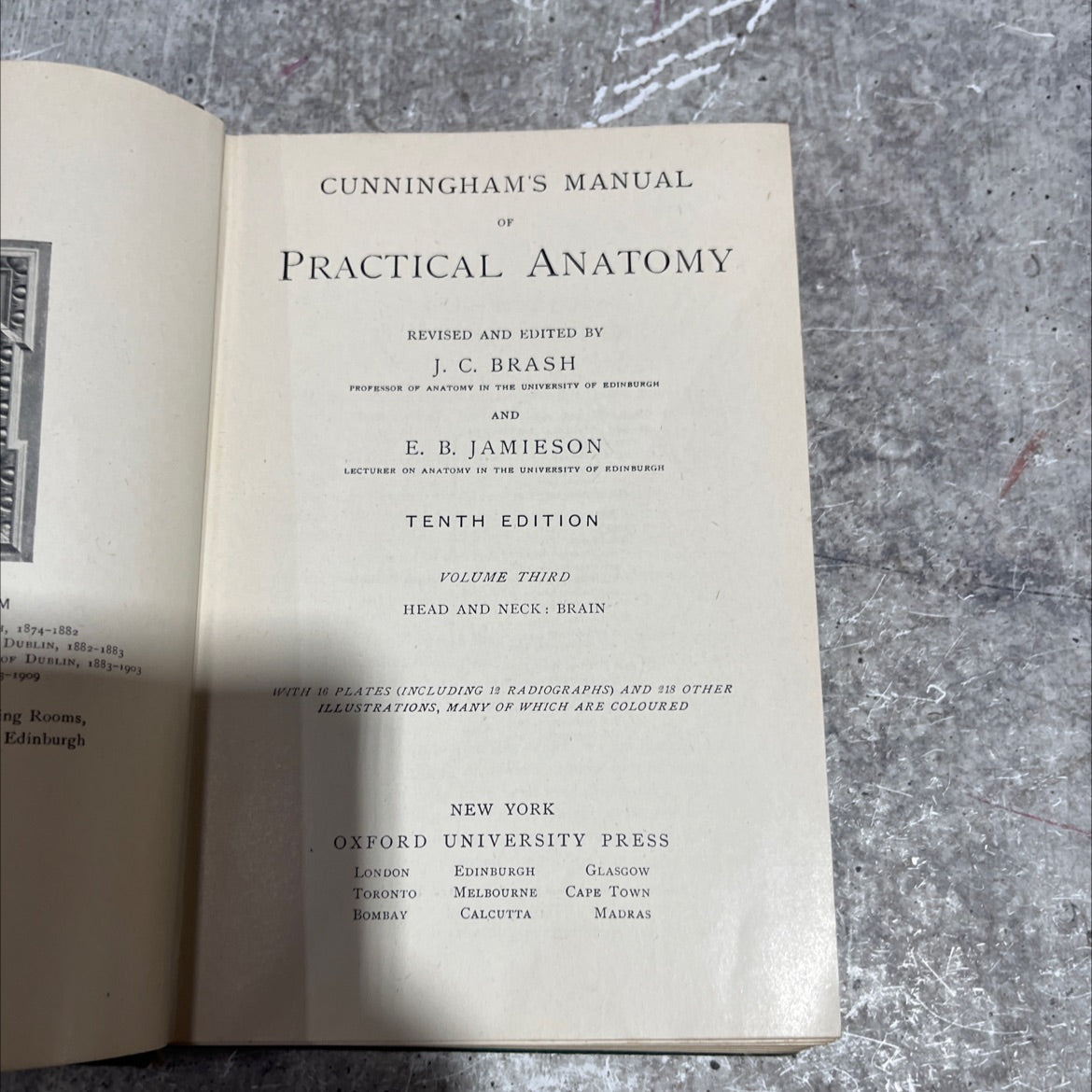 cunningham's manual of practical anatomy revised and edited by j. c. brash and e. b. jamieson tenth edition volume image 2
