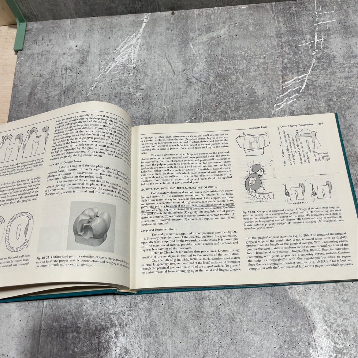 the art and science of operative dentistry book, by Clifford M. Sturdevant, Roger E. Barton, John C. Brauer, M. Lamar image 4