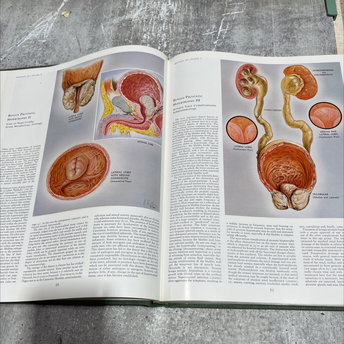 the ciba collection of medical illustrations volume 2 book, by frank h. netter, m.d., 1970 Hardcover image 4