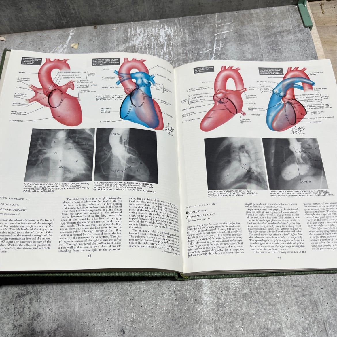 the ciba collection of medical illustrations volume 5 book, by frank h. netter, m.d., 1974 Hardcover image 4
