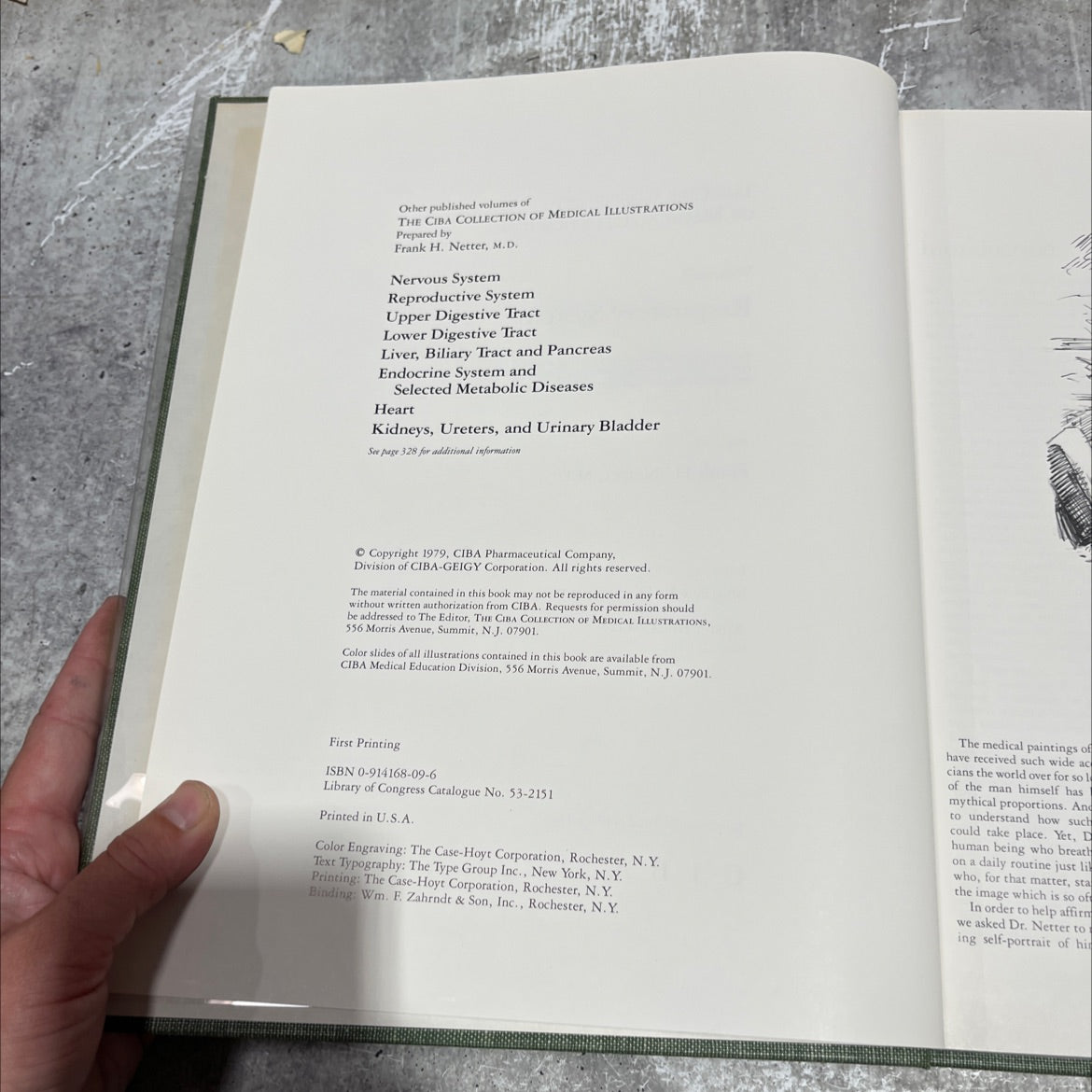 the ciba collection of medical illustrations volume 7 respiratory system book, by frank h. netter, m.d., 1979 Hardcover image 3