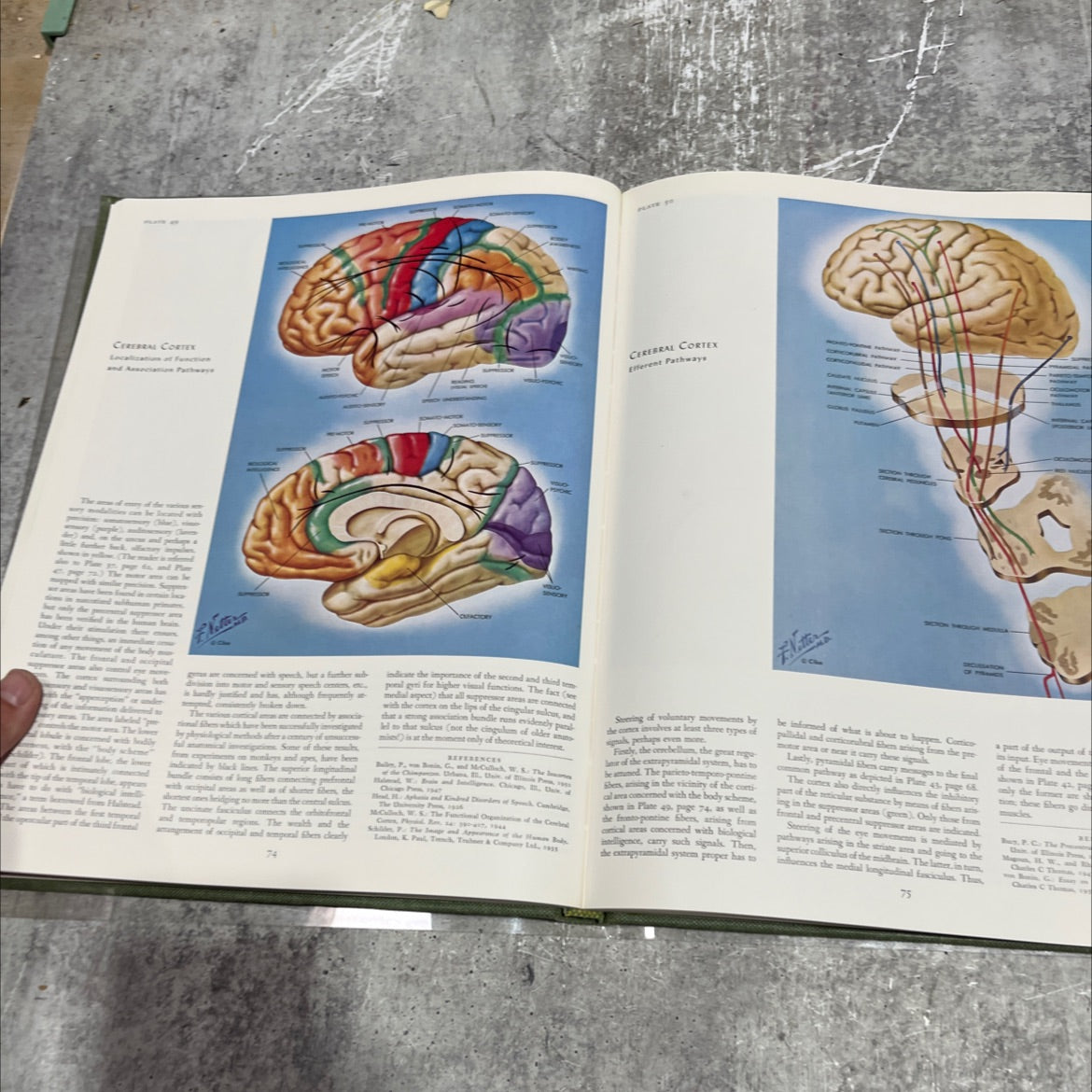 the ciba collection of medical illustrations volume i book, by frank h. netter, m.d., 1972 Hardcover image 4